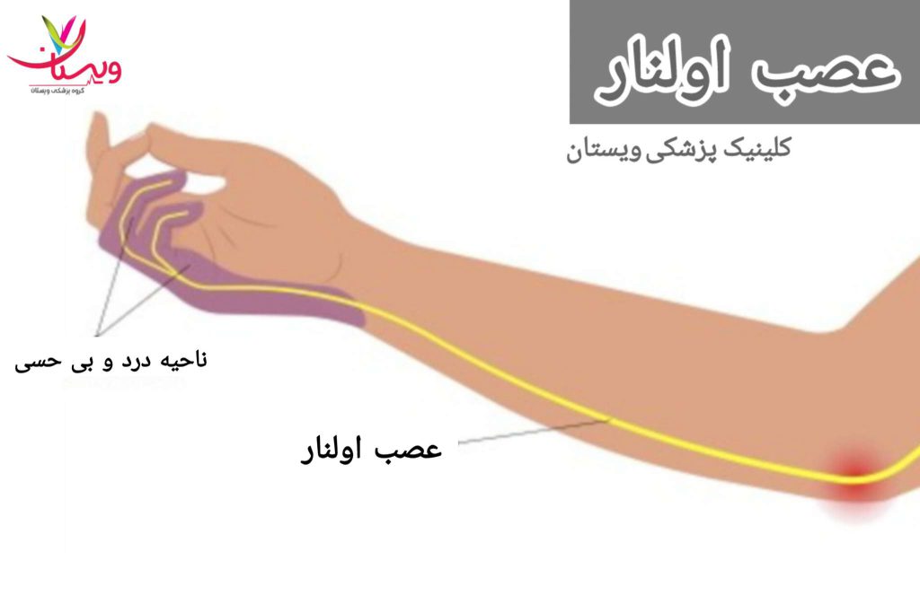 از نظر حس، عصب اولنار تأمین حس کف دستی انگشت کوچک و قسمت داخلی انگشت حلقه را انجام میدهد. عصب اولنار