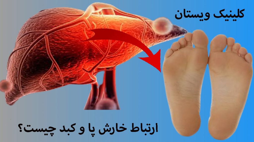 خارش پا و کبد پاهای انسان و تصویری از کبد در کنار آن