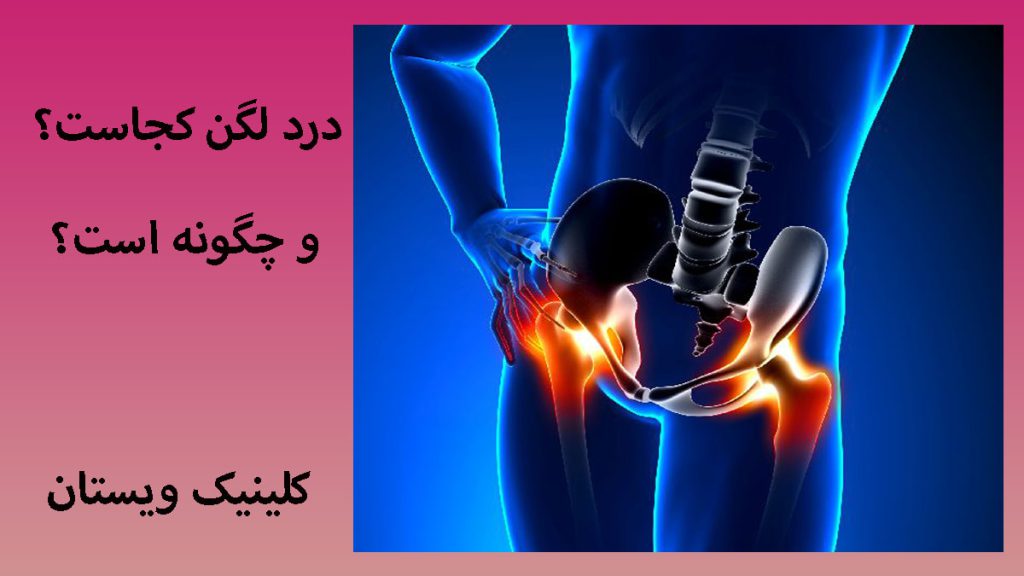 درد لگن کجاست یک تصویر از لگن شخص