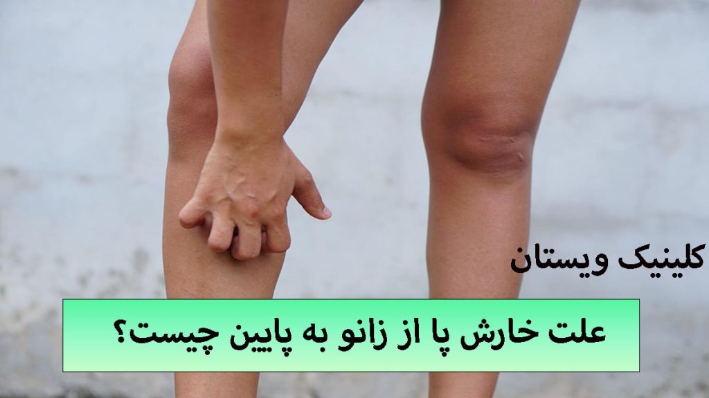 علت خارش پا از زانو ساق پای یک شخص که دچار خارش شده است