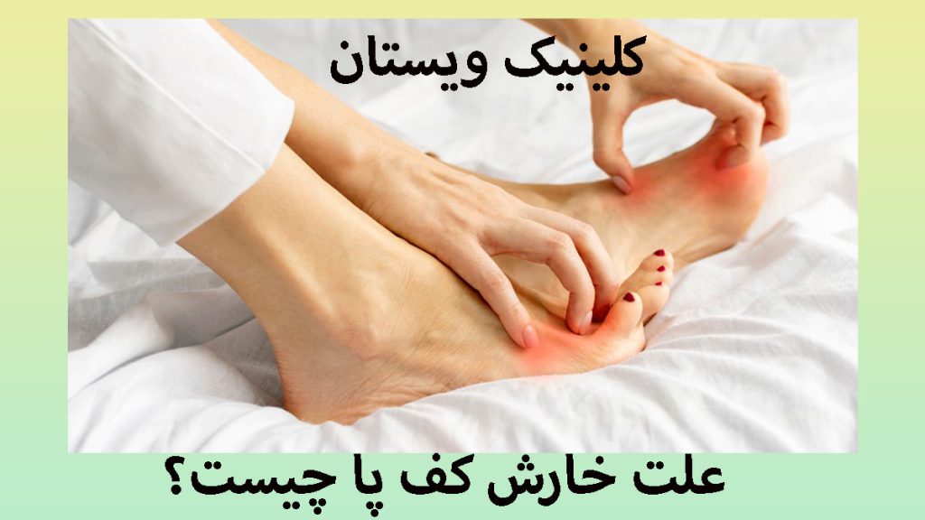 علت خارش کف پا پای یک شخص که دچار خارش کف پا شده است