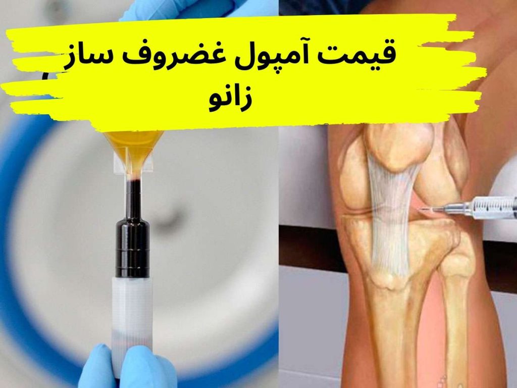 غضروف ساز قیمت آمپول غضروف ساز زانو 1403