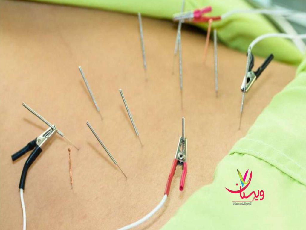 حفظ وزن سالم مراقبتهای بعد از امبدینگ لاغری چیست