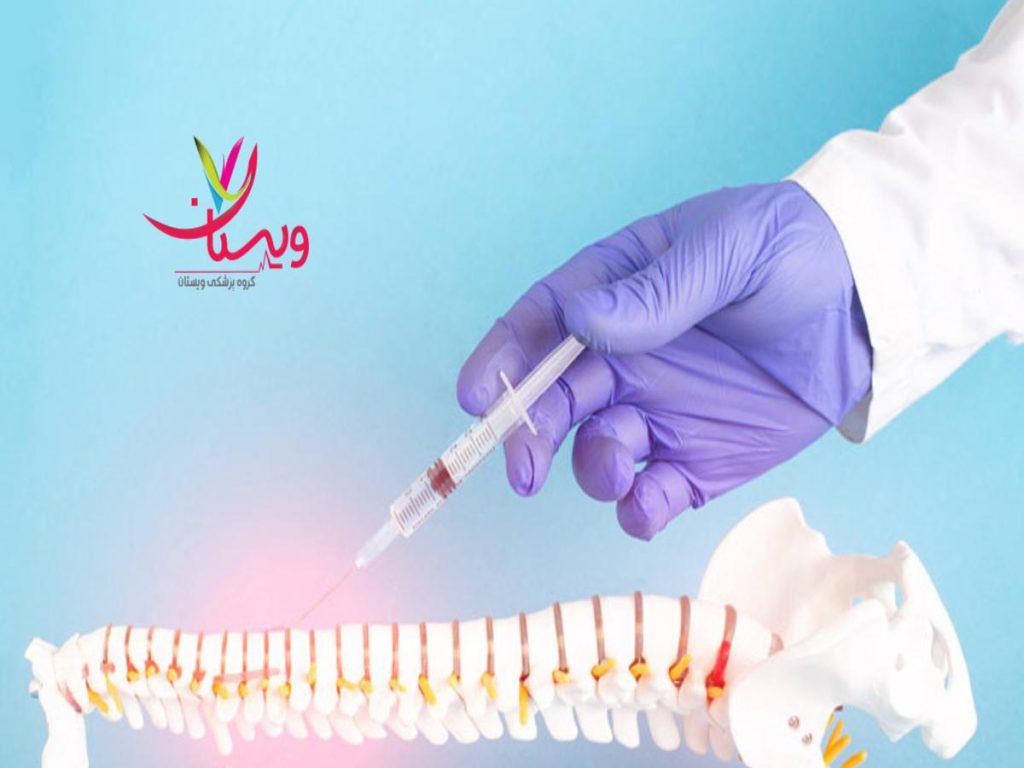 بهبود و ترمیم بافتها توسط prp درد کمر و امپول پی آر پی