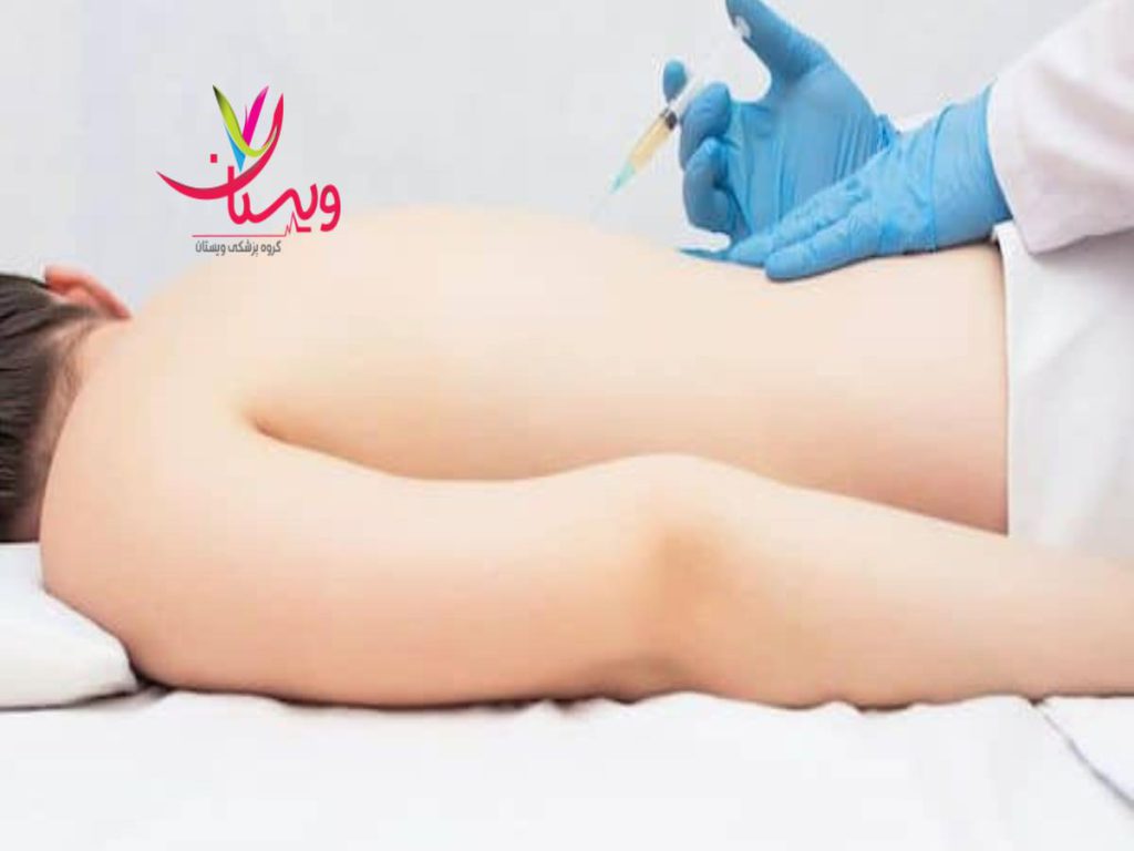 نظرات مردم در مورد پی ار پی کمر