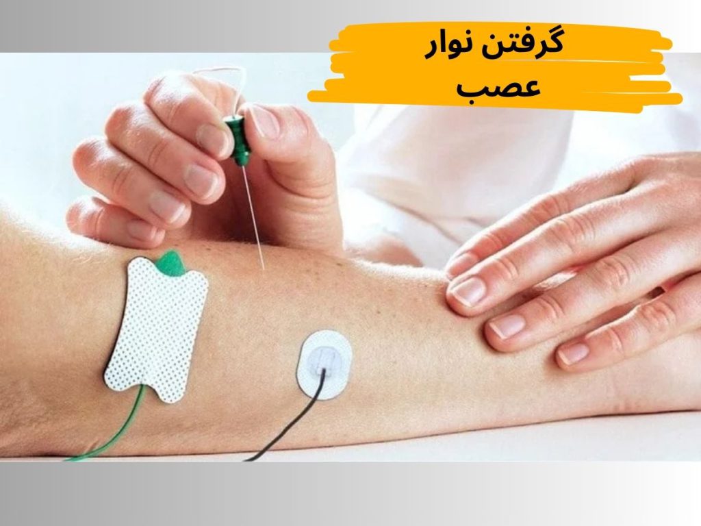 تشخیصی مانند نوار عصب و عضله نوار عصب و عضله برای بیماران ام اسی
