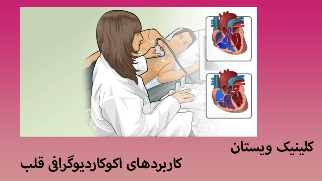 کاربردهای اکوکاردیوگرافی دو تصویر از قلب در کنار یک پزشک در حال انجام اکو قلب