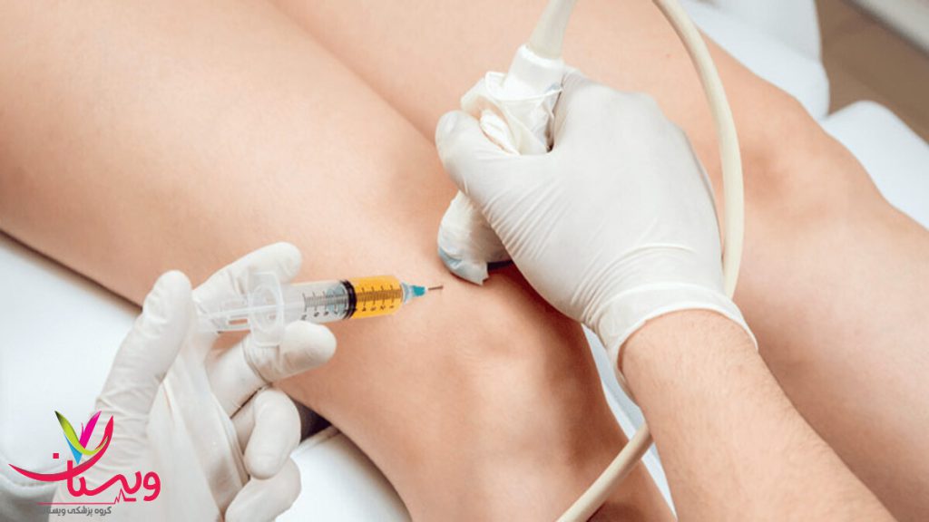 تزریق PRP برای بهبود درد زانو مزایا و معایب پی آر پی به زانو برای کاهش درد و التهاب