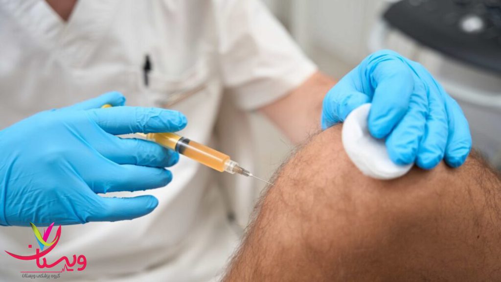 کاهش درد زانو با PRP استفاده از تزریق PRP برای کاهش درد مفصل زانو