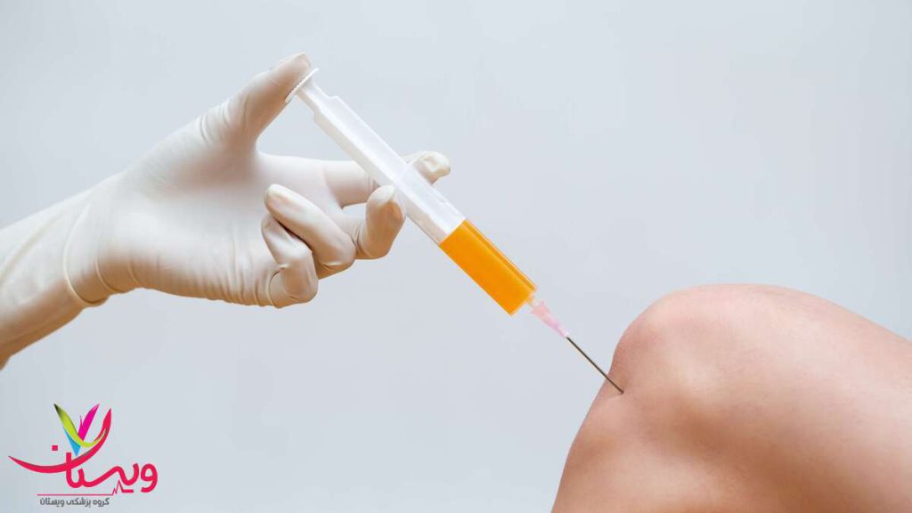 تزریق پلاسمای غنی از پلاکت برای بازسازی بافت زانو