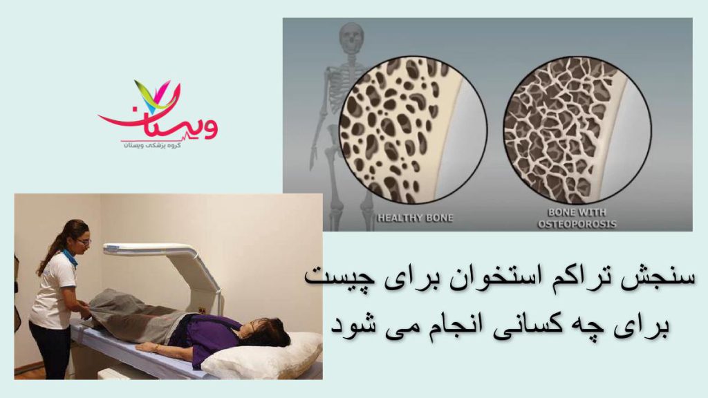 چرا سنجش تراکم استخوان مهم است سنجش تراکم استخوان برای چیست؟