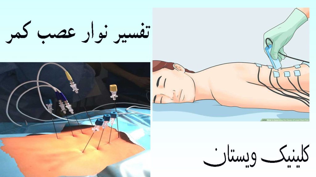 تفسیر نوار عصب کمر دو تصویر از یک بیمار در حال انجام نوار عصب کمر