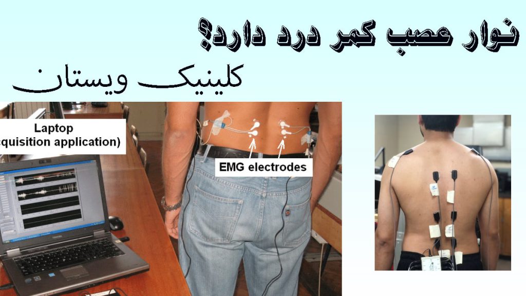 دردر نوار عصب کمر دو تصویر از نوارر عصب کمر