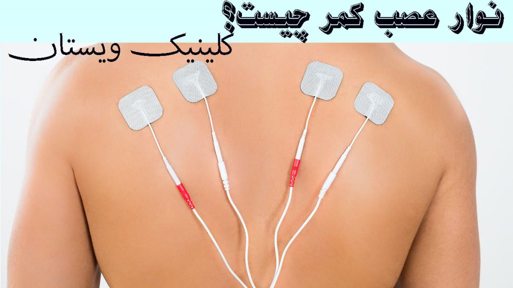 نوار عصب کمر الکترودهای نوار عصب به پشت فرد متصل هستند