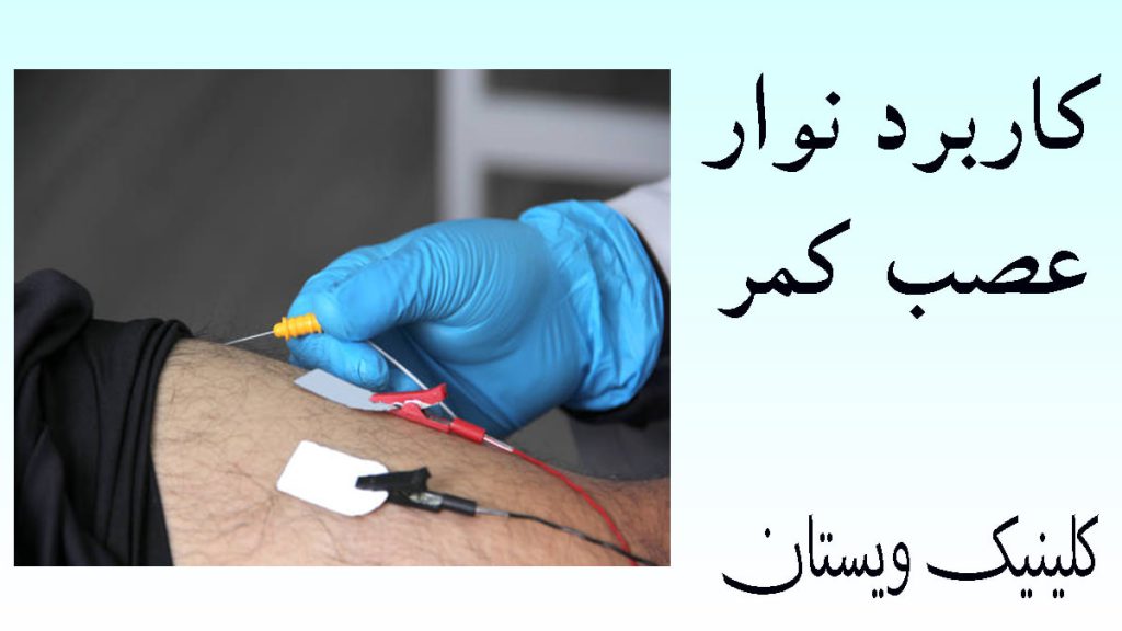 کاربردهای نوار عصب کمر یک پزشک در حال اتصال الکترود نوار عصب به کمر