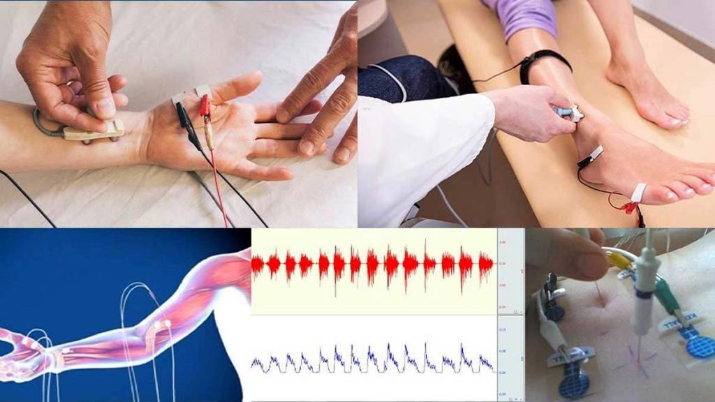هزینه emg با بیمه نیروهای مسلح هزینه نوار عصب و عضله با بیمه نیورهای مسلح در کلینیک ویستان