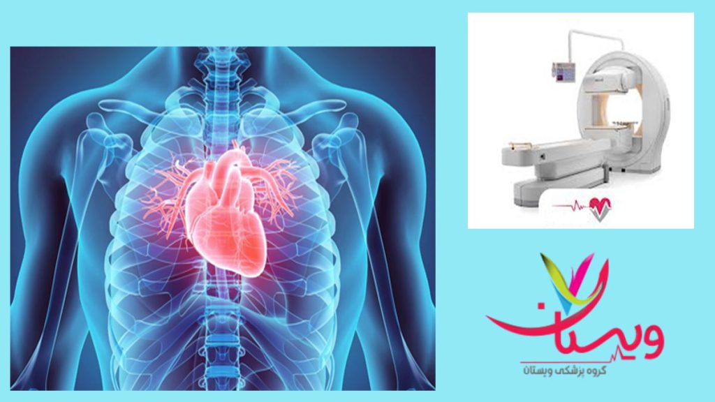 مرکزهای دولتی اسکن قلب هستهای شناختن مراکز درمانی دولتی جهت انجام اسکن برای قلب