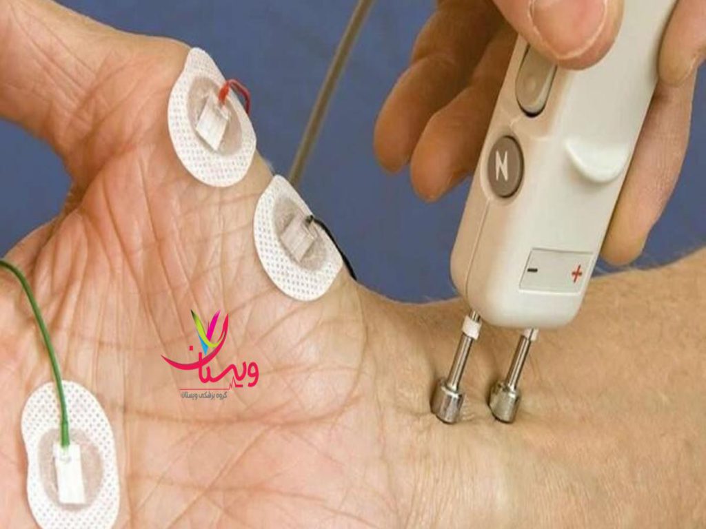 تست نوار عصب و عضله عوامل موثر بر قیمت تست نوار عصب و عضله دست
