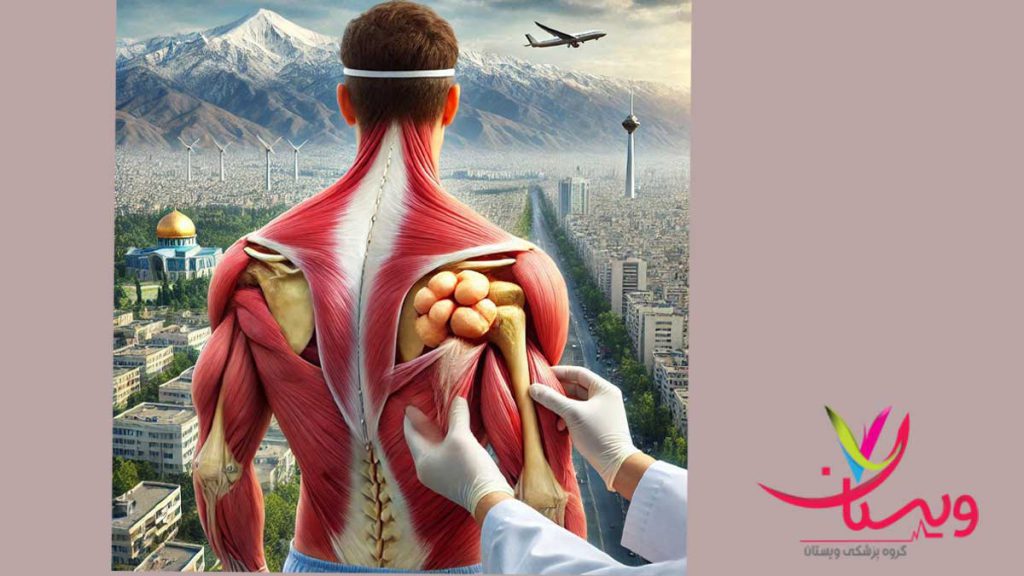 پی ار پی تاندون شانه یک روش غیر تهاجمی است.