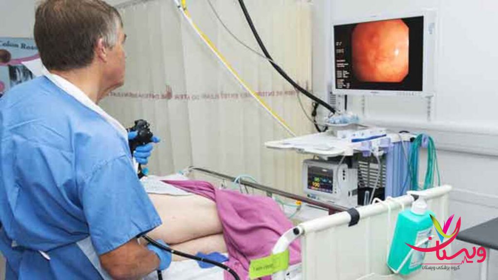 پزشک در حال انجام کولونوسکوپی به صورت مستقیم