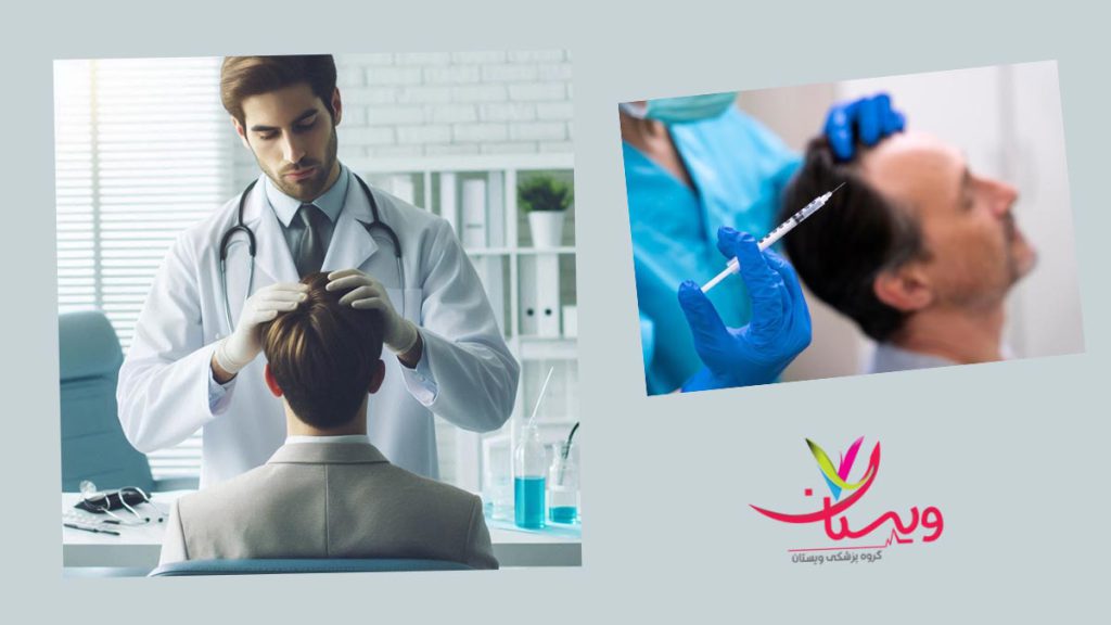 مزیتهای prp مو مزایای پی ار پی از نظر بهترین دکتر prp مو