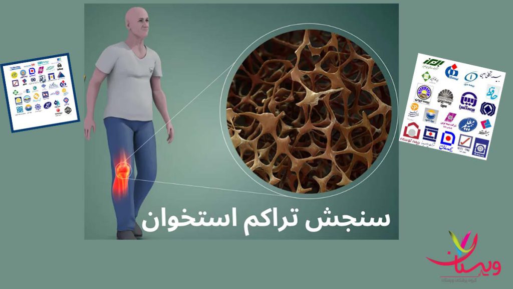 بیمههای طرف قرارداد تراکم استخوان انجام تست سنجش تراکم استخوان با پوشش بیمه