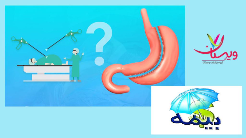 هزینههای اسلیو با بیمه پوشش بیمه برای اسلیو معده