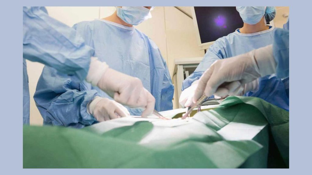 انتخاب بهترین بیمه برگزیدن بیمه خوب برای اسلیو معده