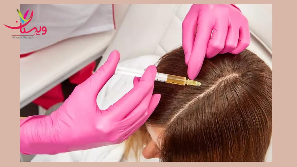 معرفی متخصصین تزریق پی ار پی مو معارفه با دکترهای prp