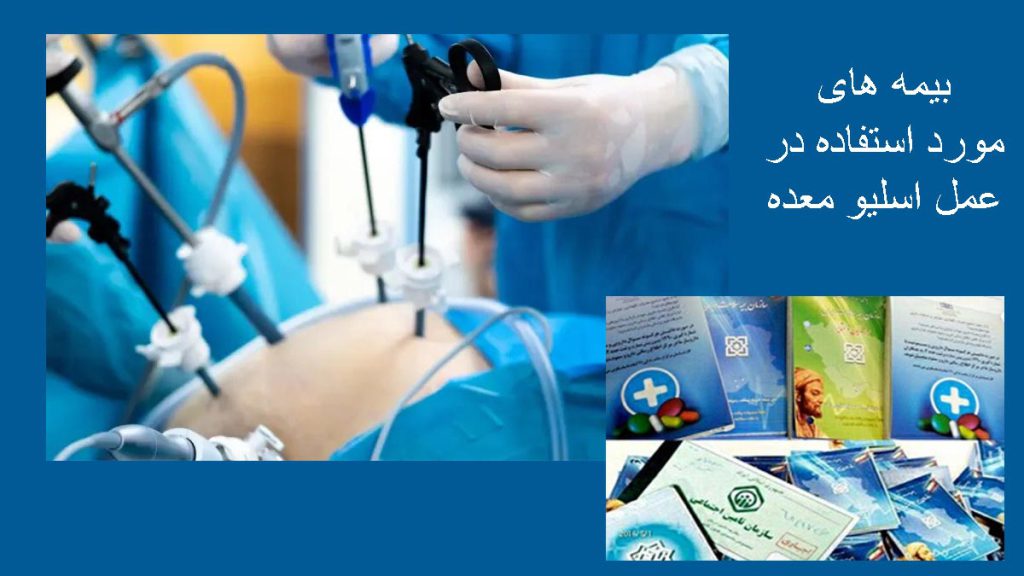 پوشش هزینه اسلیو معده با همهی بیمهها؟ میزان پوشش بیمه جهت اسلیو معده