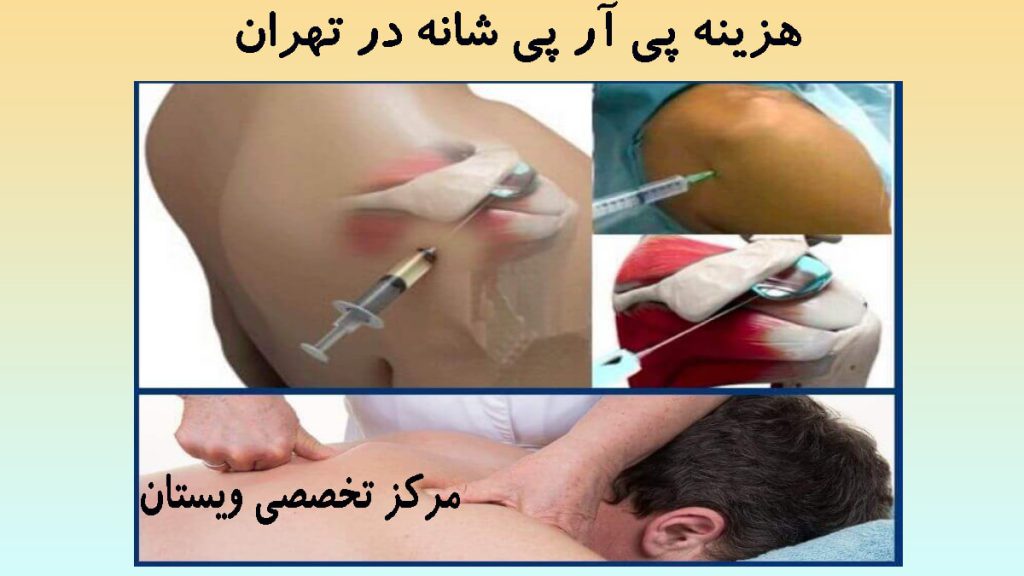 پی آر پی شانه در تهران چند تصویر در کنار هم از تزریق پی ار پی به مفاصل