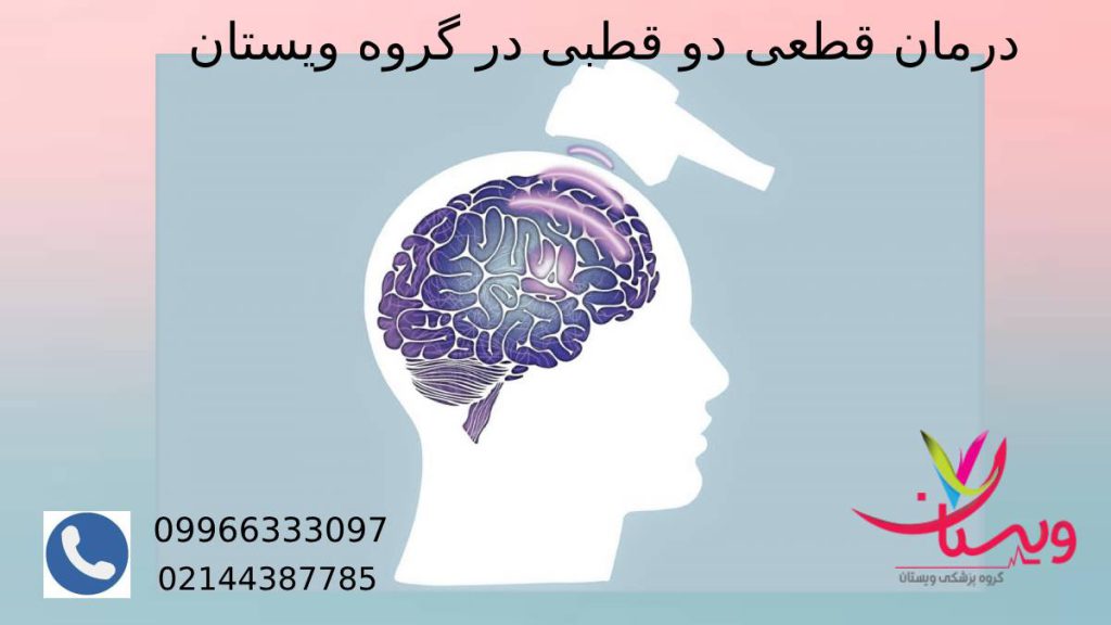 چگونگی درمان اختلال دوقطبی درمان دوقطبی با rTMS در گروه ویستان