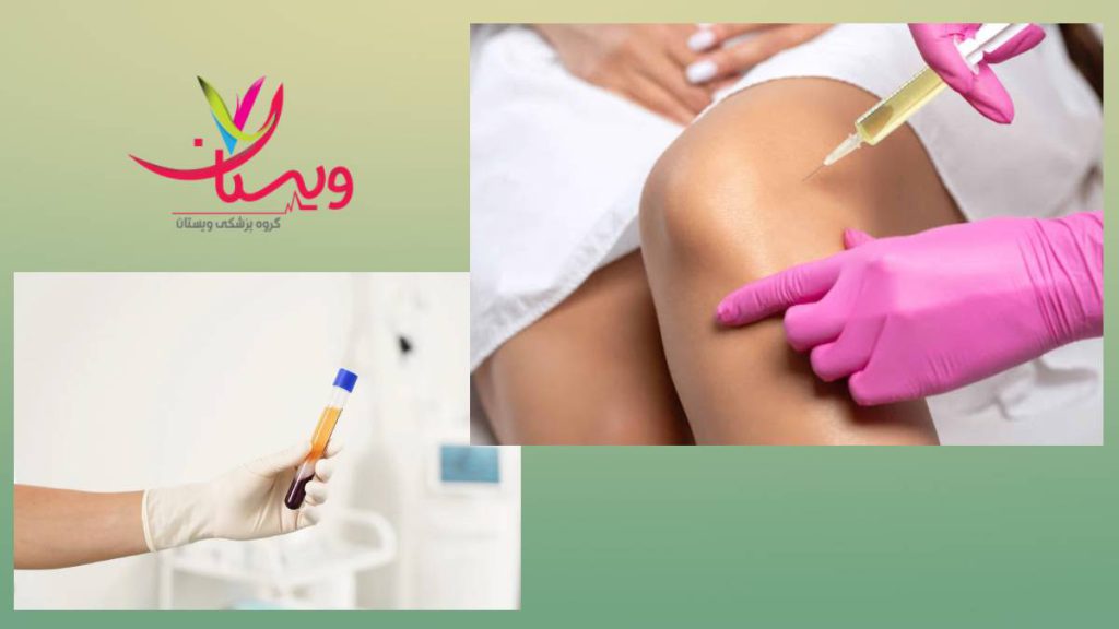 سنجش هزینه روشهای دیگر مقایسه اگزوزوم زانو و روشهای دیگر
