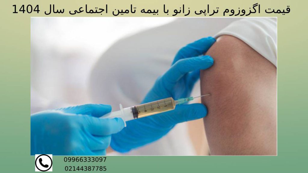 هزینه اگزوزوم تراپی زانو سال 1404