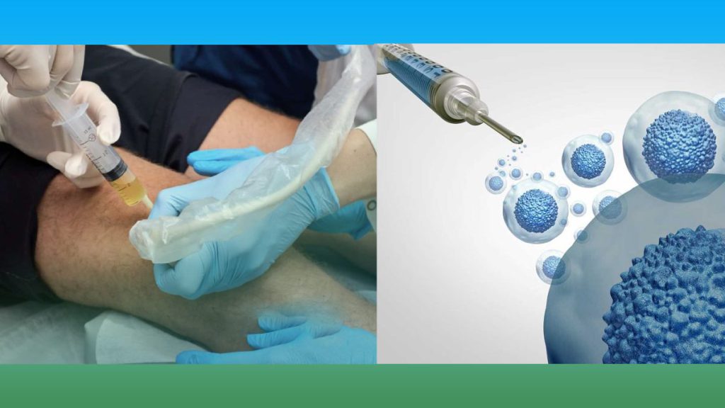 ویژگیهای مراکز و بیمارستانهای معتبر خصوصیات مراکز تزریق سلول بنیادی