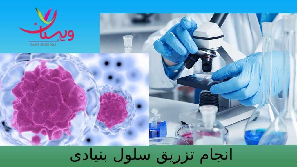 مرحلههای انجام تزریق سلول بنیادی