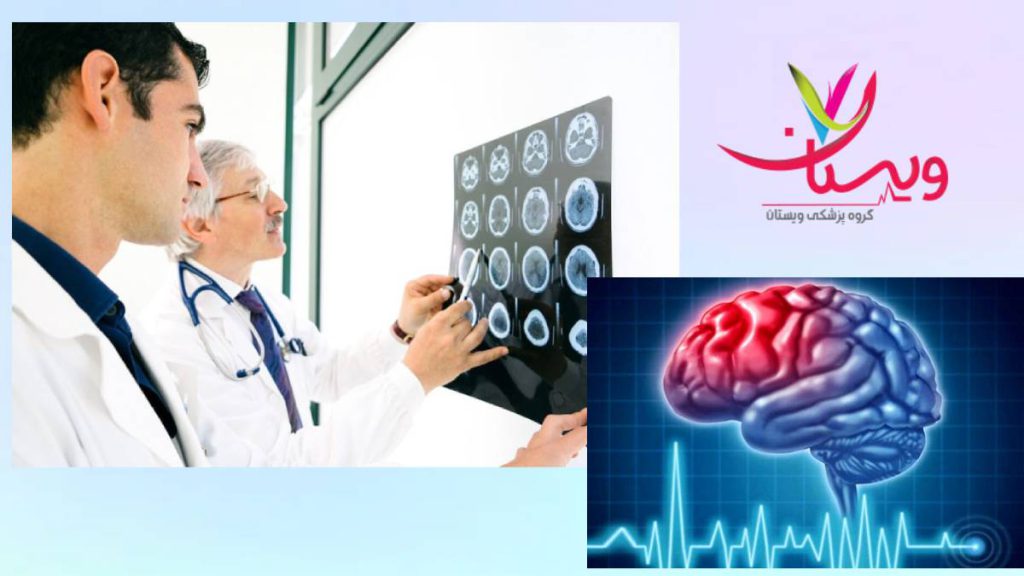 متخصص مغز و اعصاب در بیمارستان فوق تخصص سکته مغزی در بیمارستانهای دولتی تهران