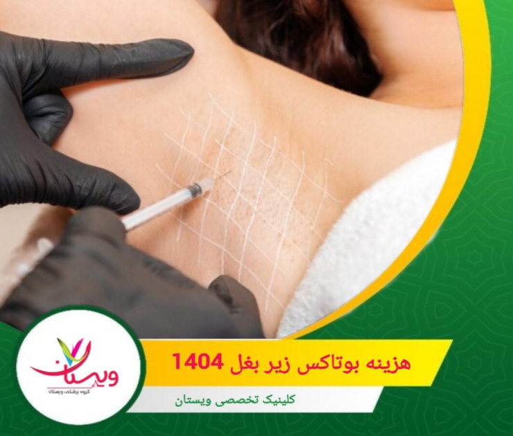 هزینه تزریق بوتاکس زیر بغل به عوامل متعددی بستگی دارد. هزینه بوتاکس زیر بغل ۱۴۰۵