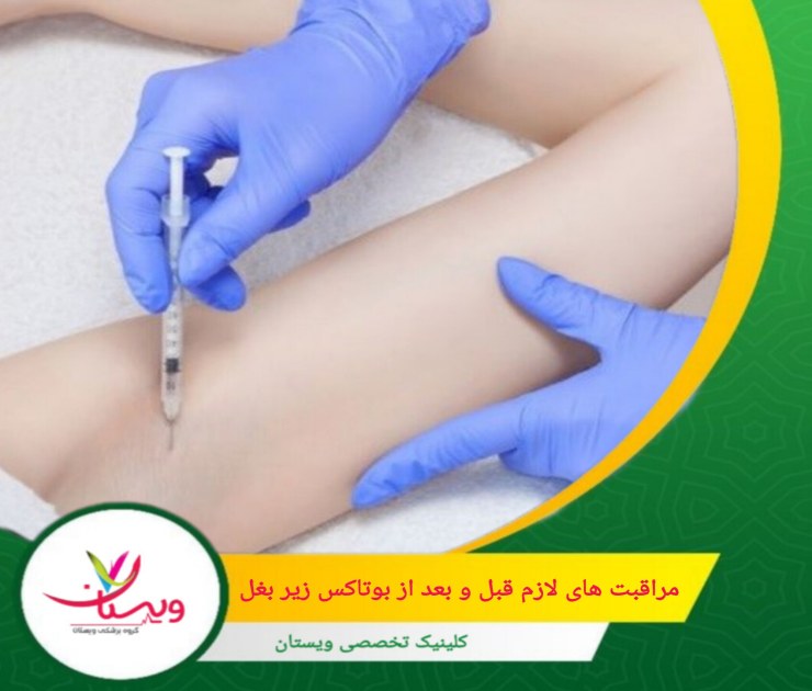 بهتر است از ورزشهای شدید و فعالیتهای فیزیکی سنگین دو روز قبل از تزریق اجتناب کنید. مراقبتهای لازم قبل و بعد از بوتاکس زیربغل