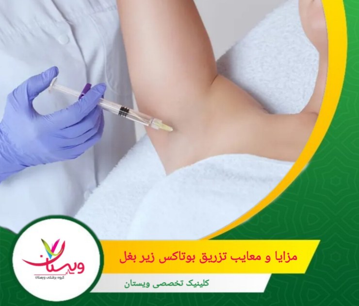 در حال حاضر، بوتاکس فقط برای تعریق زیر بغل توسط FDA تأیید شده است. مزایا و معایب تزریق بوتاکس زیر بغل