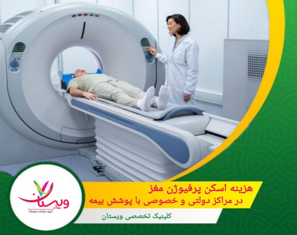 هزینه اسکن پرفیوژن مغز | در مراکز دولتی و خصوصی با پوشش بیمه
