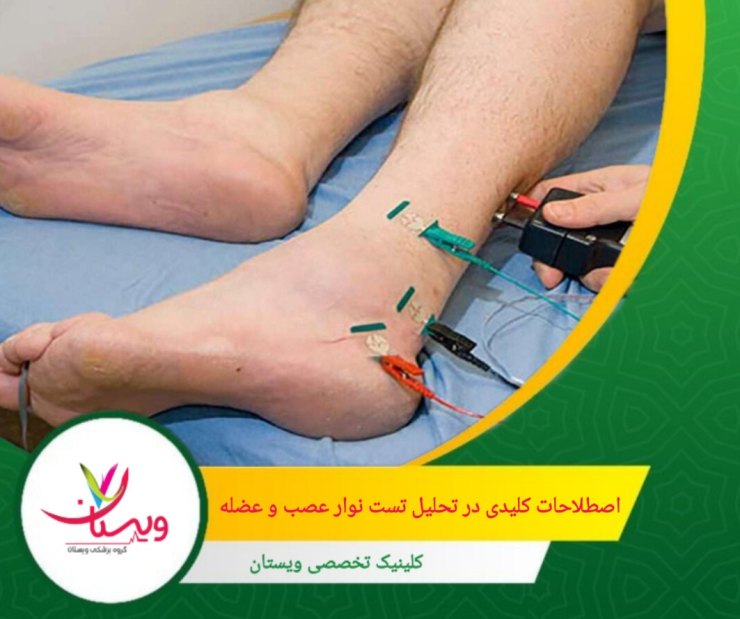 دامنه پاسخ عصبی میزان فعالیت الکتریکی تولید شده توسط عصب را نشان میدهد. کاهش دامنه ممکن است به آسیب آکسونی مرتبط باشد. اصطلاحات کلیدی در تحلیل تست نوار عصب و عضله