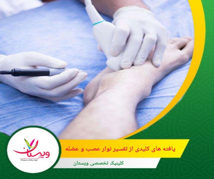 کاهش سرعت هدایت عصبی در یک نقطه خاص ممکن است نشانه گیر افتادن عصب، مانند سندرم تونل کارپال یا نوروپاتی فشاری باشد. یافتههای کلیدی از تفسیر نوار عصب و عضله