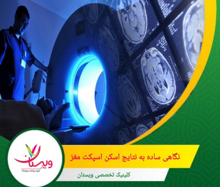 افزایش جریان خون، میتواند به فعالیت غیرطبیعی مغز مانند صرع یا تومورهای مغزی اشاره کند. نگاهی ساده به نتایج اسکن اسپکت مغز