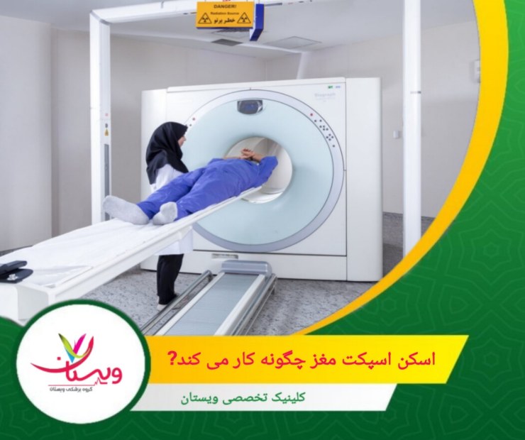 این تکنولوژی پیشرفته به دلیل دقت بالا و توانایی در ارائه اطلاعات عملکردی مغز، به ابزاری حیاتی در تشخیص و مدیریت بیماریهای عصبی تبدیل شده است. اسکن اسپکت مغز چگونه کار می کند؟
