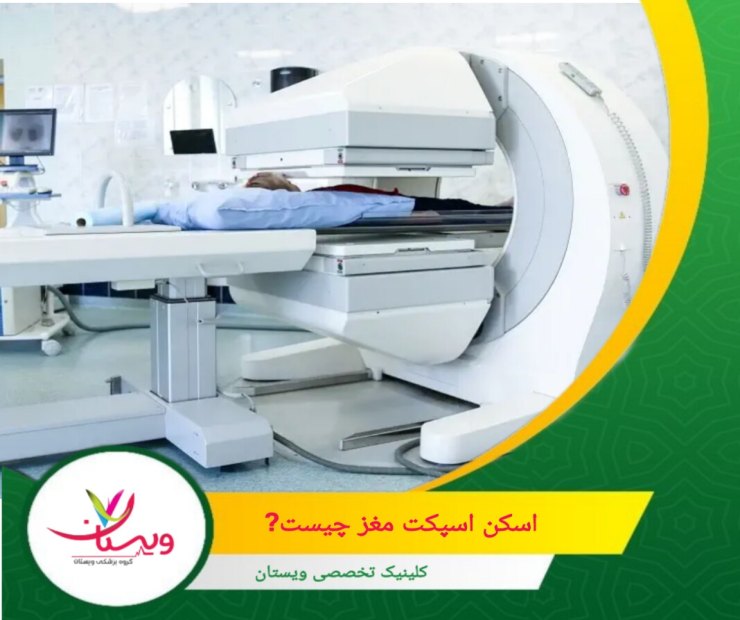 اسکن اسپکت مغز (SPECT) یا "توموگرافی کامپیوتری با انتشار تک فوتون" یکی از پیشرفتهترین روشهای تصویربرداری پزشکی است. اسکن اسپکت مغز چیست؟