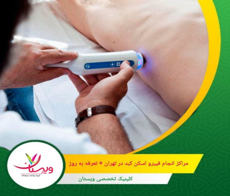 کلینیک ویستان دارای ویژگی های نوبت دهی سریع و کیفیت بالا در ارائه خدمات است. مراکز انجام فیبرو اسکن کبد در تهران + تعرفه بهروز