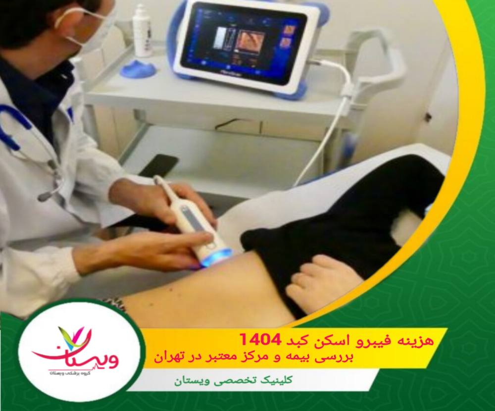 هزینه فیبرو اسکن کبد ۱۴۰۴ | بررسی بیمه و مرکز معتبردر تهران