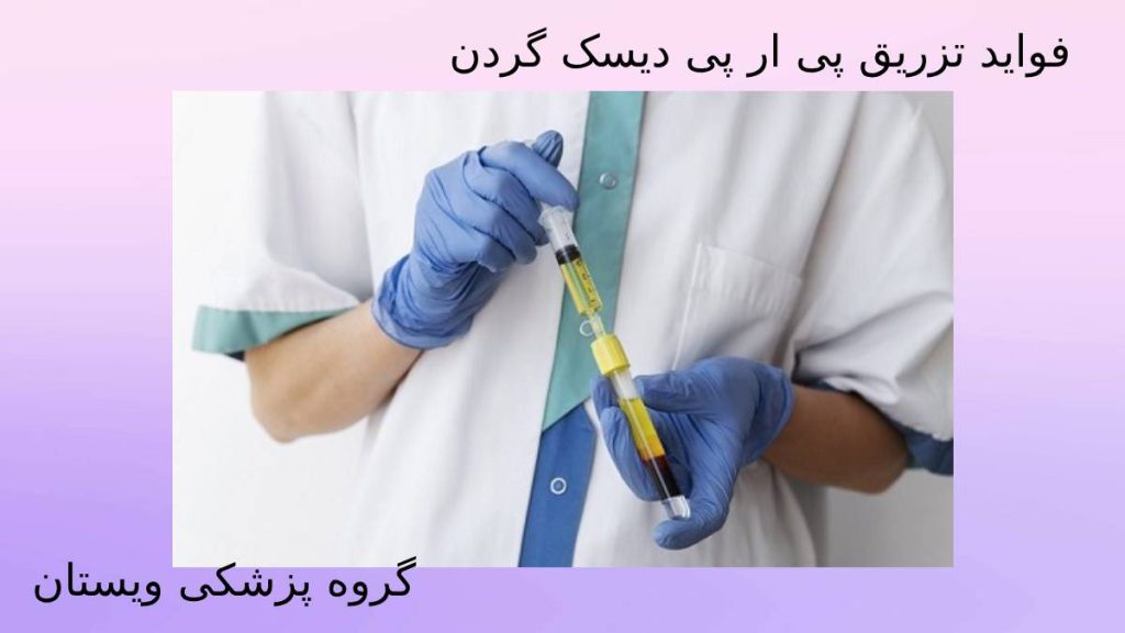 مزایای prp درمانی گردن فایدههای تزریق پی آر پی دیسک گردن