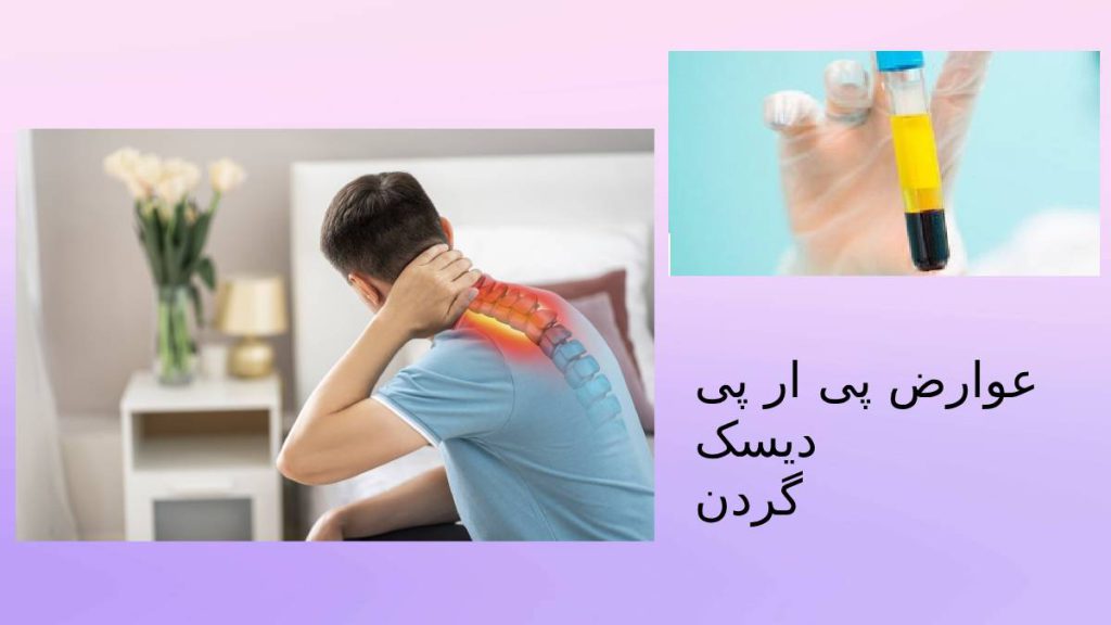 عوارض تزریق پی ار پی خطرات پی ار پی دیسک گردن
